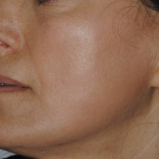 laser-estetica21