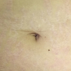 laser-estetica31